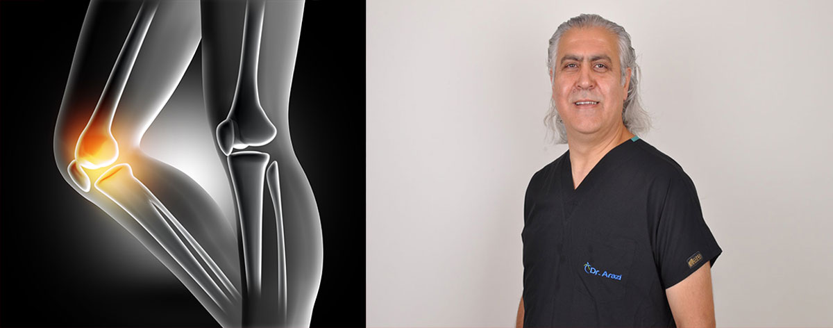 DİZ PROTEZİ AMELİYATI SONRASI DİZİM NE KADAR BÜKÜLEBİLECEK?