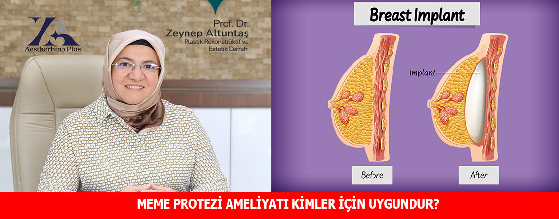 MEME PROTEZİ AMELİYATI KİMLER İÇİN UYGUNDUR?